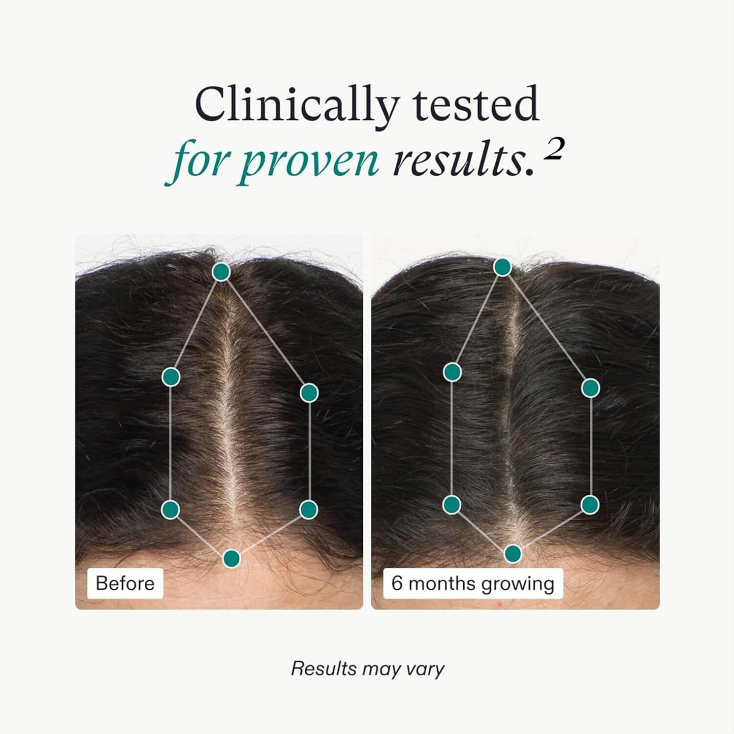 Women's Hair Growth Supplements, Ages 18-44, Clinically Proven for Visibly