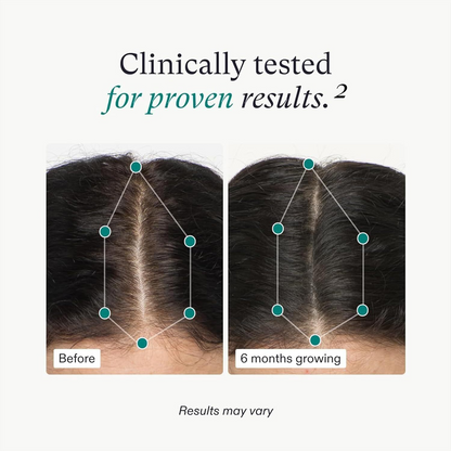 Women's Hair Growth Supplements, Ages 18-44, Clinically Proven for Visibly