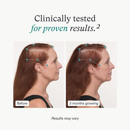 Women's Balance Hair Growth Supplements, Ages 45 and Up, Clinically Proven